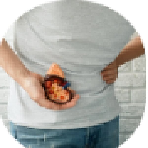 Kidney Stone