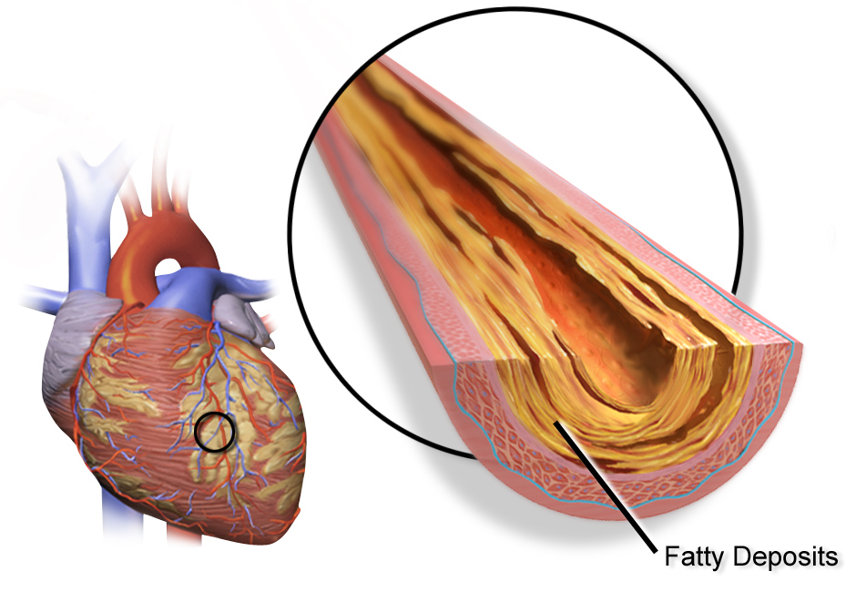 Cholesterol
