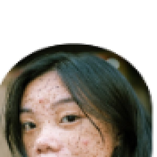Pigmentation